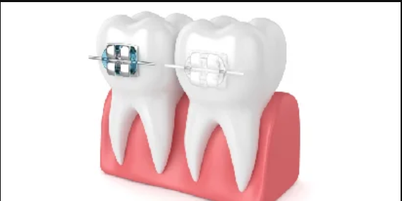 Orthodontic