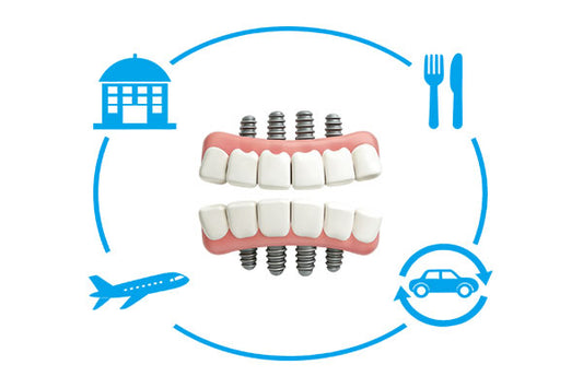 Full Mouth All-On-4 Implants Package(2 Jaws)