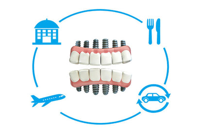 Full Mouth All-On-6 Implants Package(2 Jaws)