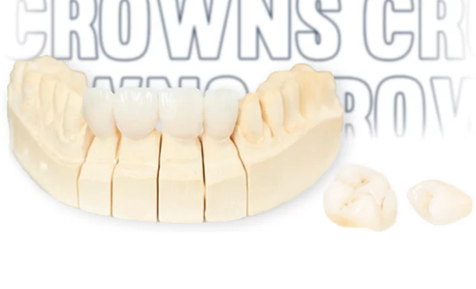 Dental Crowns